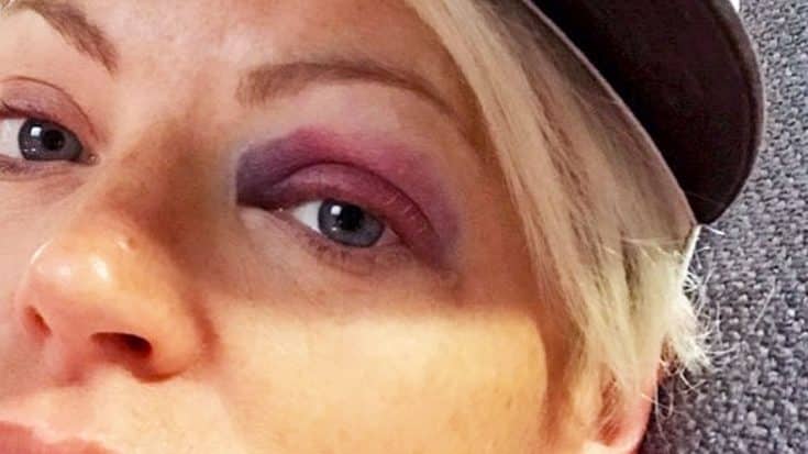 Dixie Chicks’ Natalie Maines Shares Painful Photos Of Black Eye | Country Music Videos