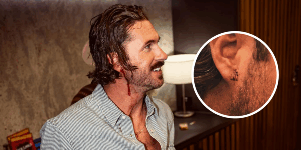 riley green with sitches on his ear