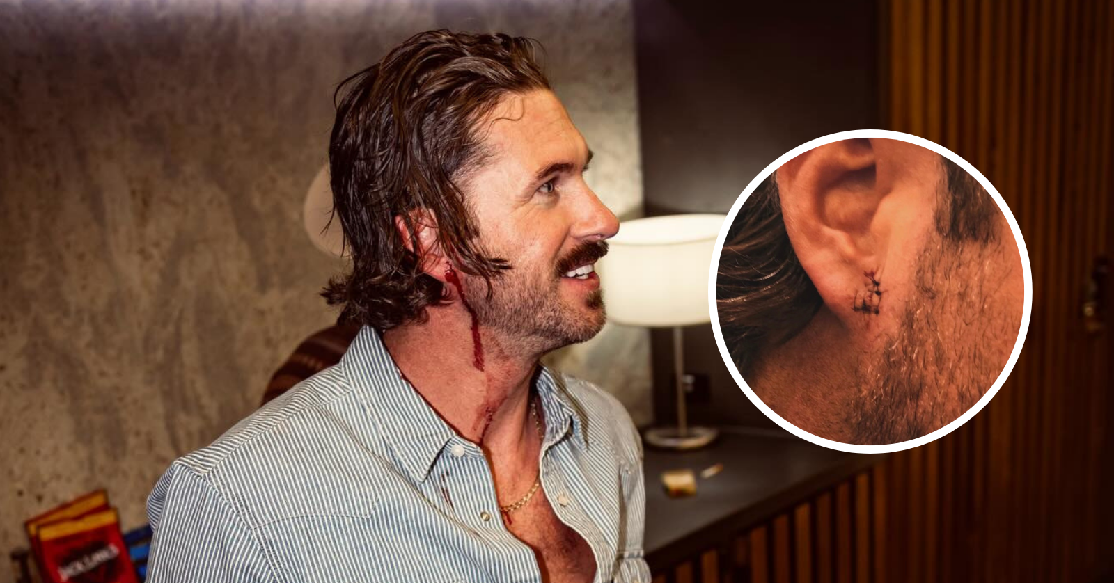 riley green with sitches on his ear