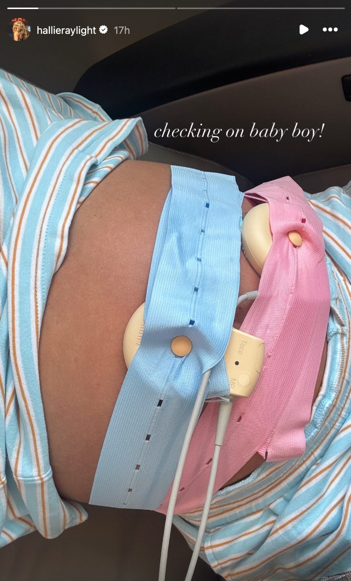 Hallie Ray McCollum shares baby update