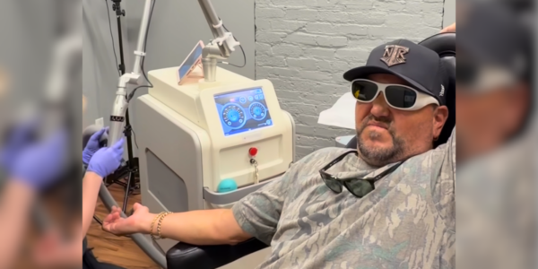 jason aldean tattoo removal