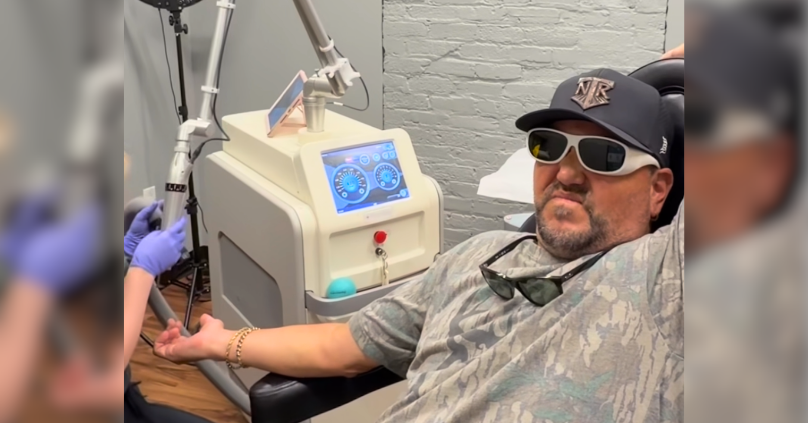 jason aldean tattoo removal